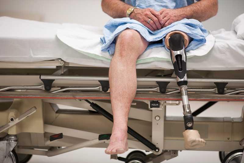 Man sitting on gurney with prosthetic leg